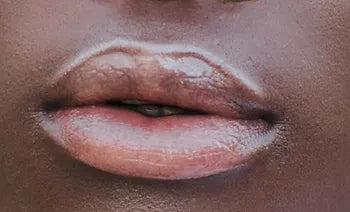 Unlocking the Secrets to Luscious Lips: A Comprehensive Guide to Lip Care